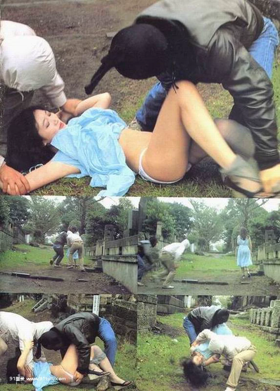 幸福的鸡毛掸子女 [22P][フェイス リフト 症例 写真]